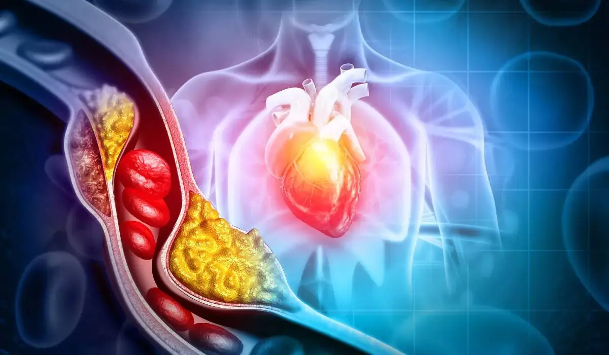 Infarctul poate apărea și cu colesterol normal: medicii explică riscurile ascunse