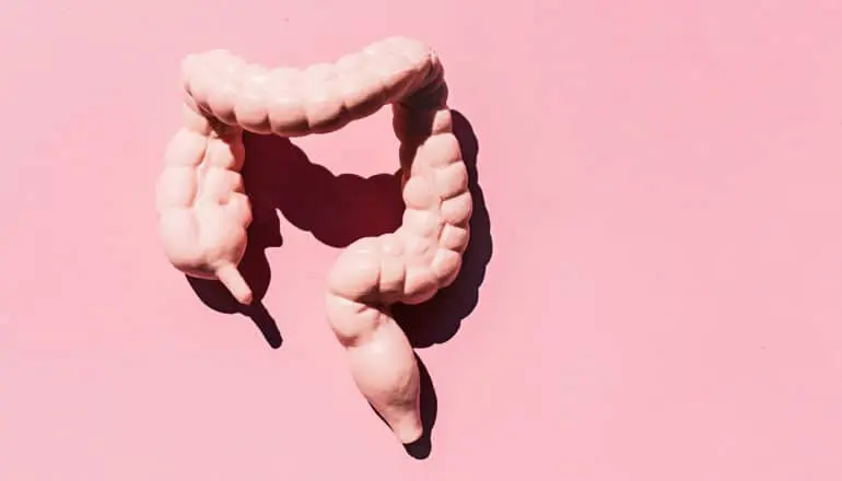 Cum evită cancerul colorectal metastatic sistemul imunitar