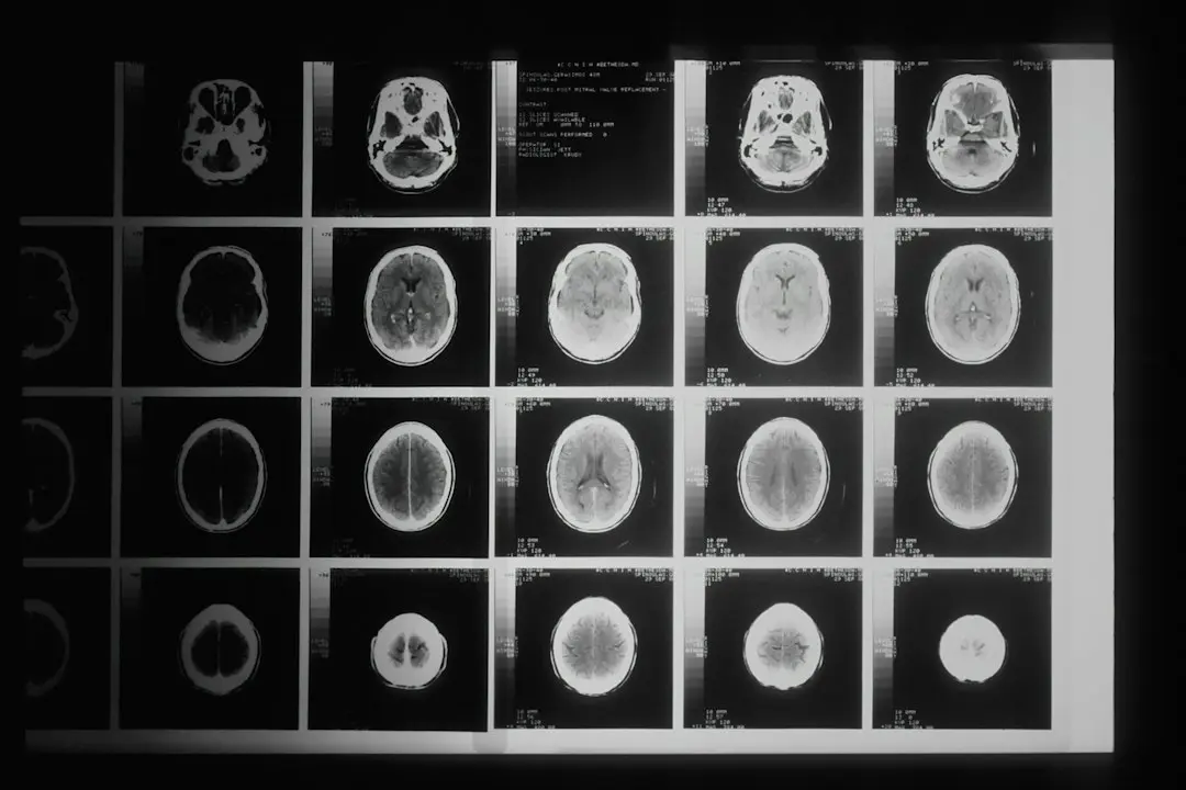 Diagnosticul Alzheimerului din sânge: progrese și limite ale unui test revoluționar